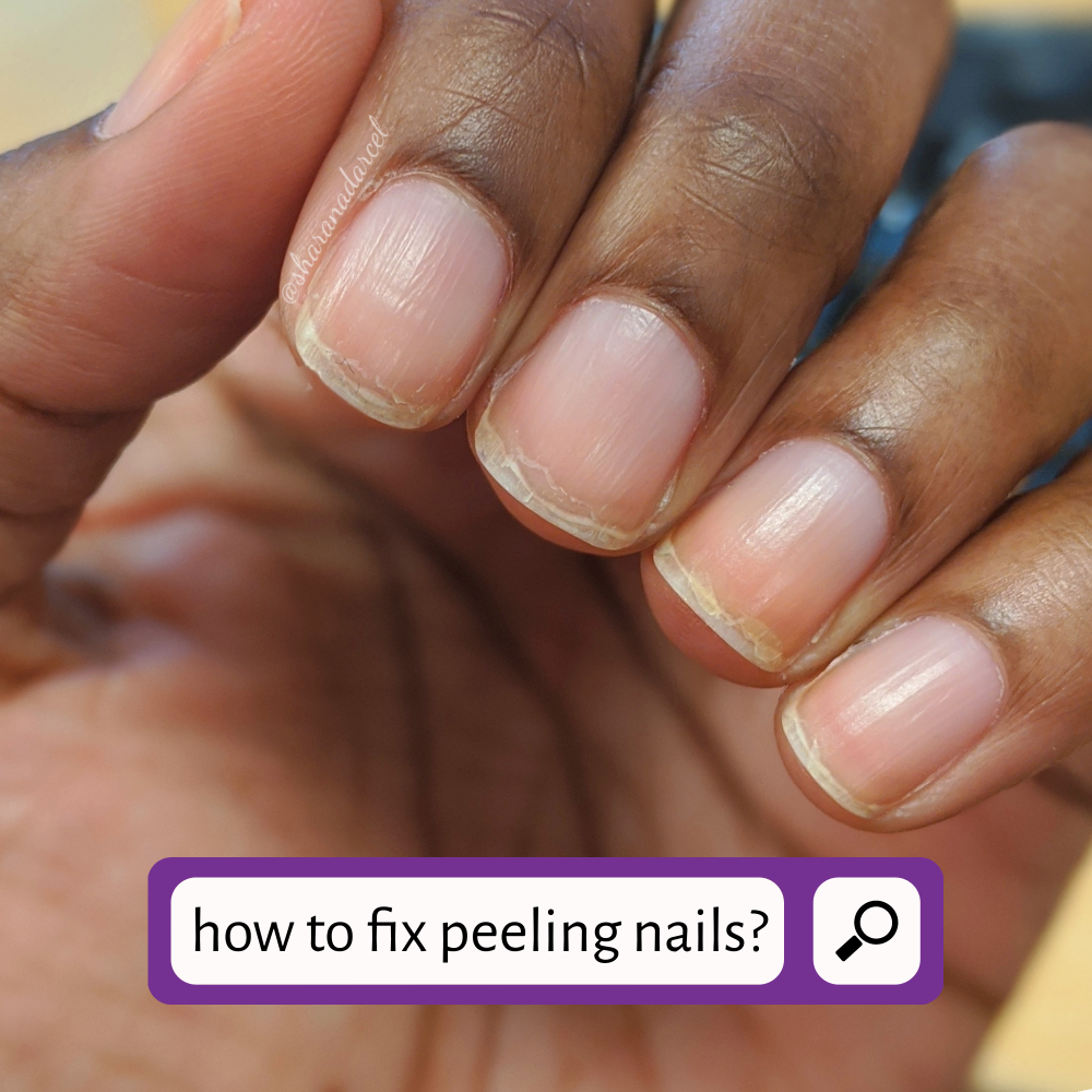 Peeling Nails? Here's What To Do About It - The Manicured Scientist %